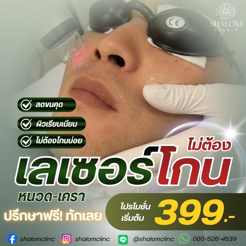 Laser Treatment